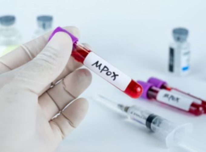 mpox-1102462