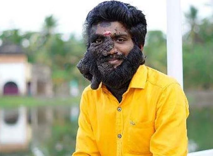 prabhulal